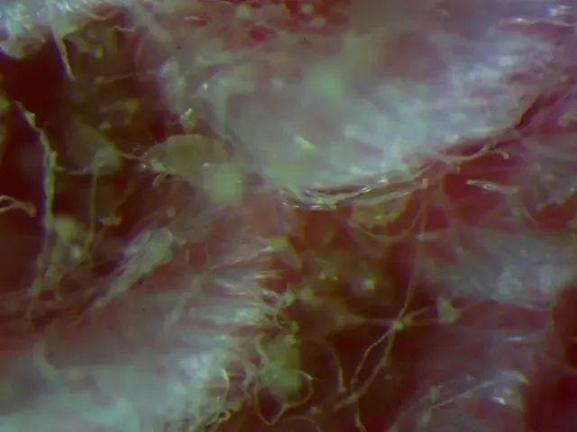 床上放个它，让螨虫绝望，让螨虫自杀，比太阳暴晒强1万倍