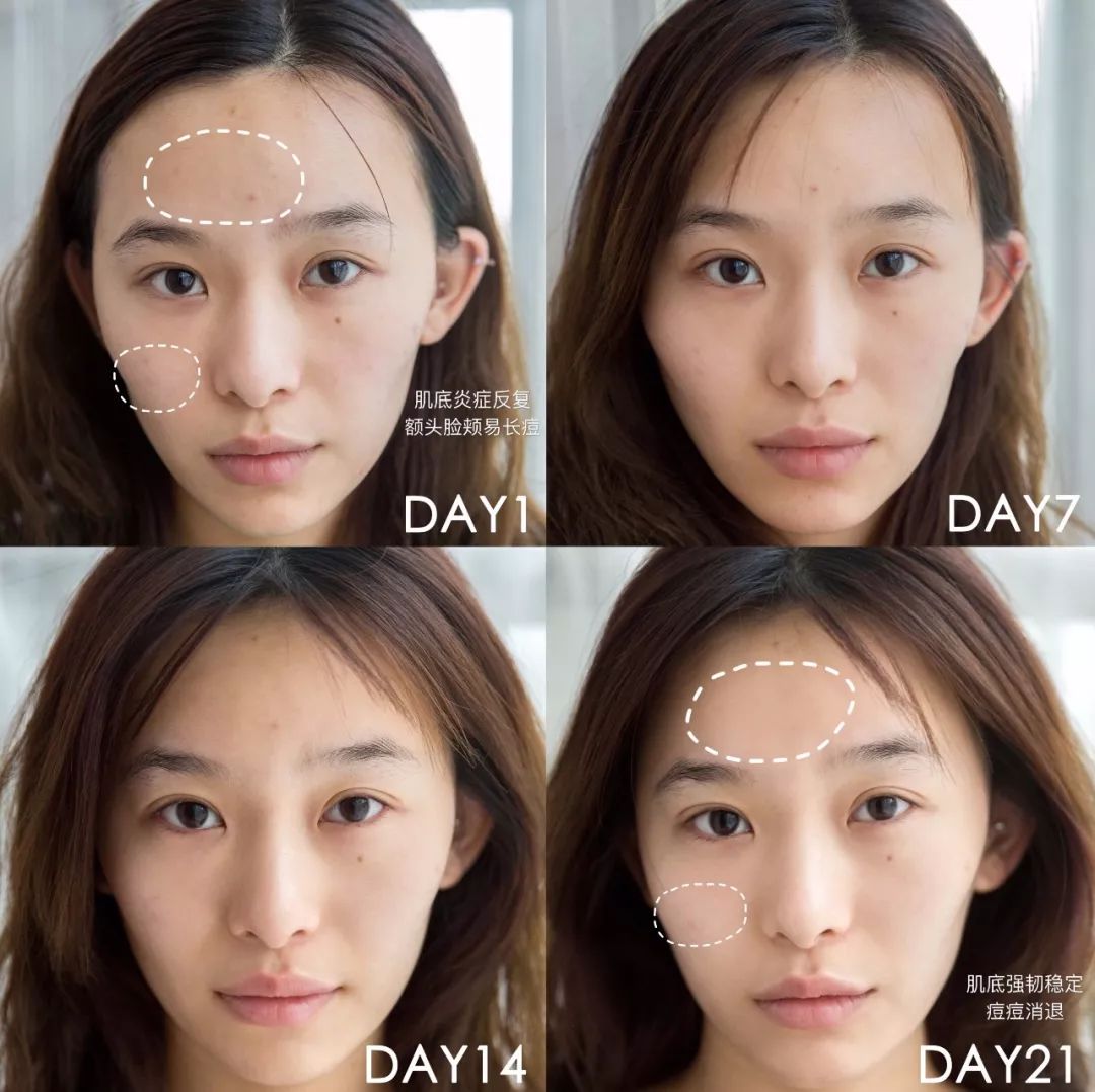 肌诊室水光肌挑战,肌诊室修复