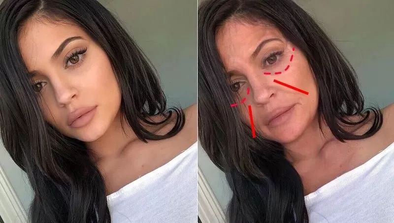 法令纹和眼纹怎么才能有效改善,法令纹贴眼贴有用吗