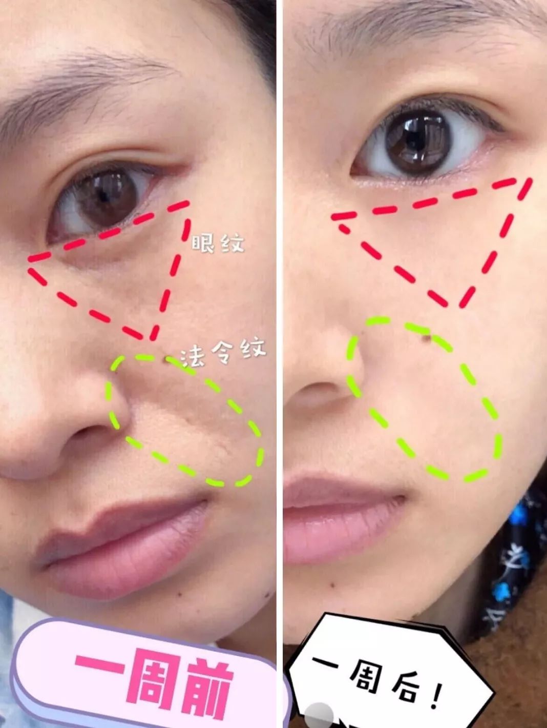 眼膜贴八小时紧致抗皱淡细纹,官方眼膜紧致抗皱淡细纹法令纹