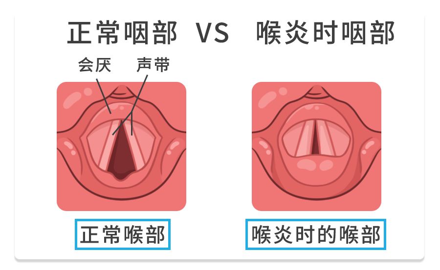 很危险！娃咳嗽发出这种“声音”是在求救，不重视会危及生命