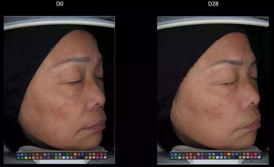 真正变白变美的方式竟然是这样,5个变白小技巧