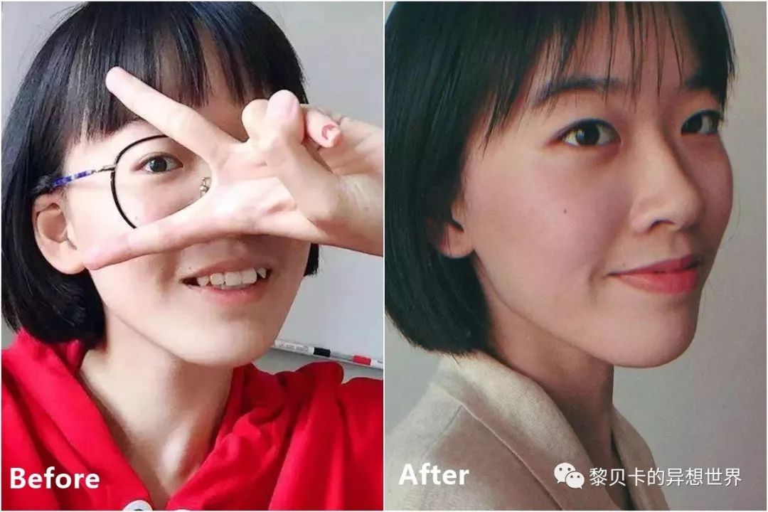 最短只要一年，这件事做对了堪比整容