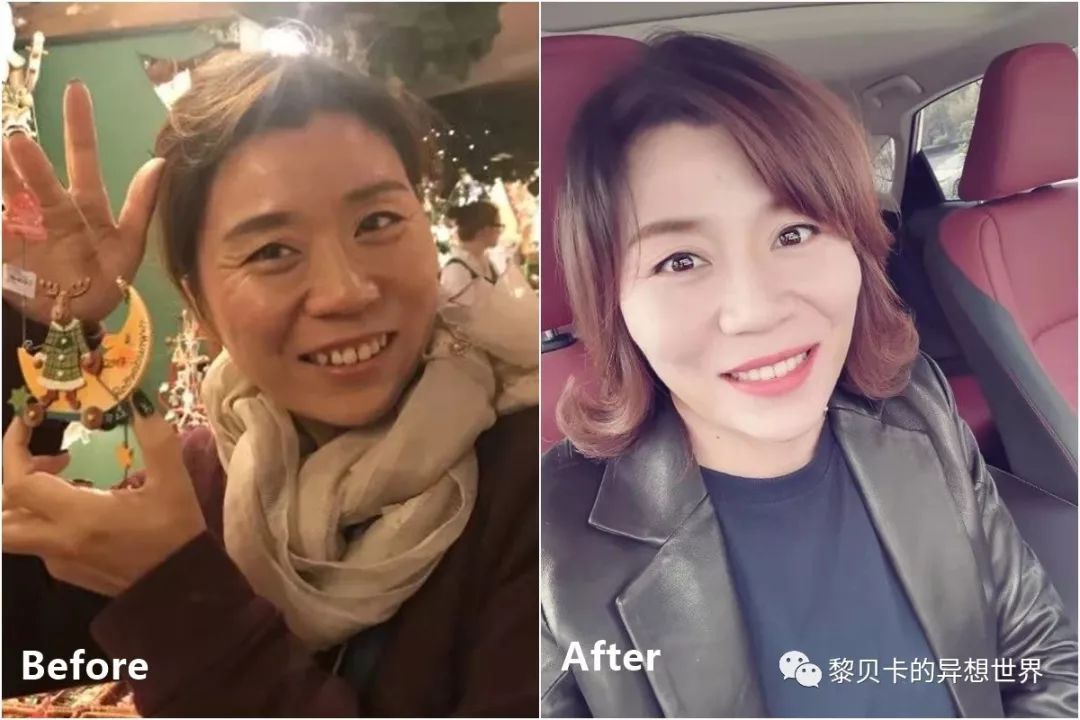 最短只要一年，这件事做对了堪比整容