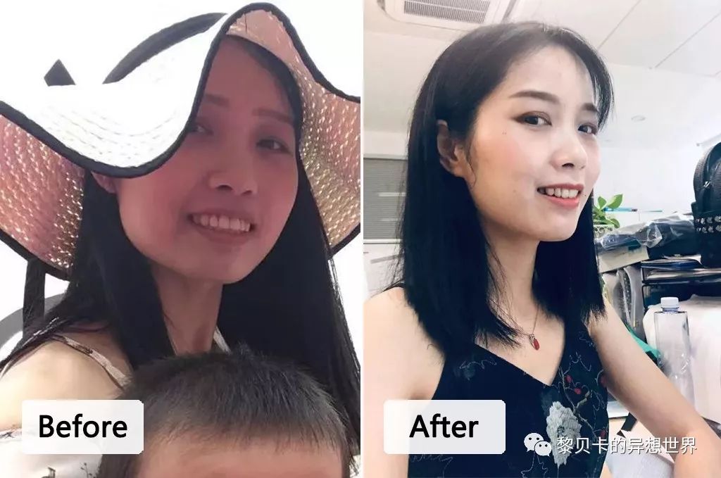 最短只要一年，这件事做对了堪比整容