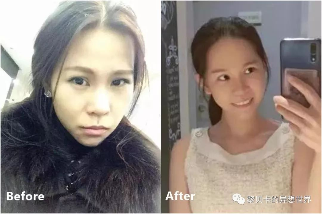 最短只要一年，这件事做对了堪比整容