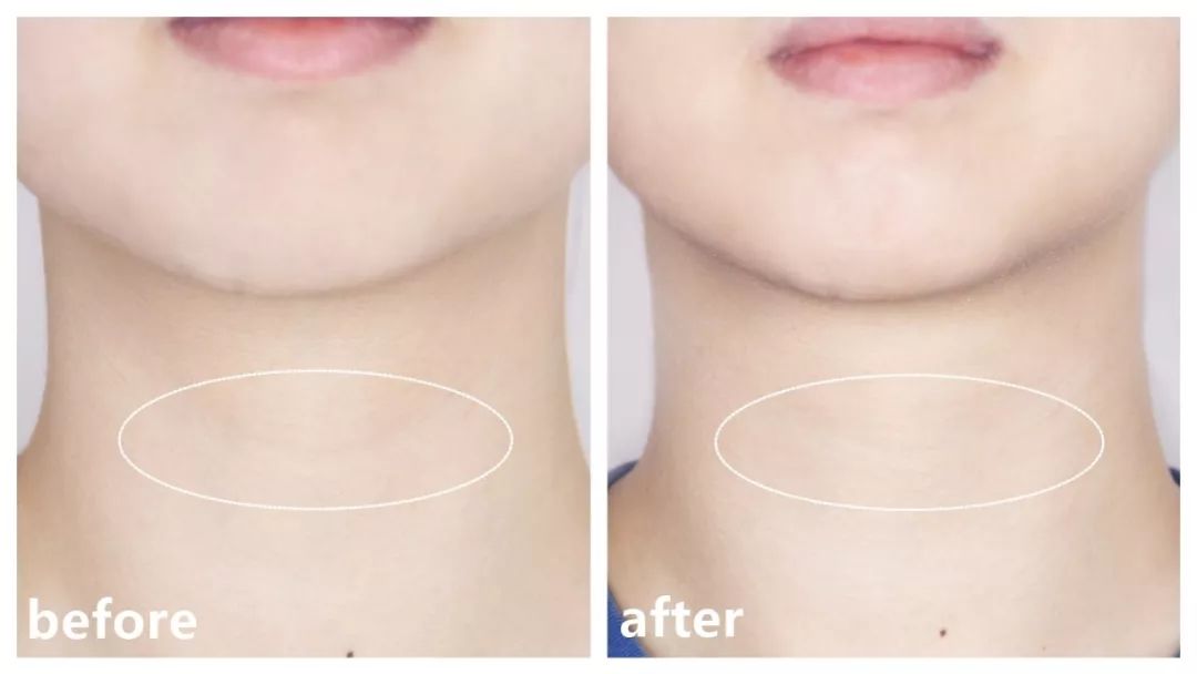 推广｜|这篇的所有单品几乎都买一送一