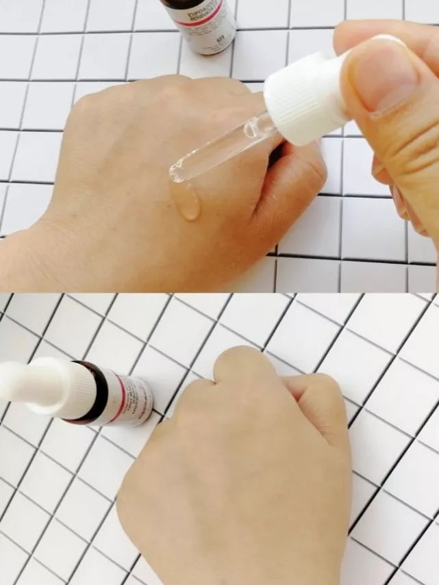 战痘总结,战痘十年是什么样子