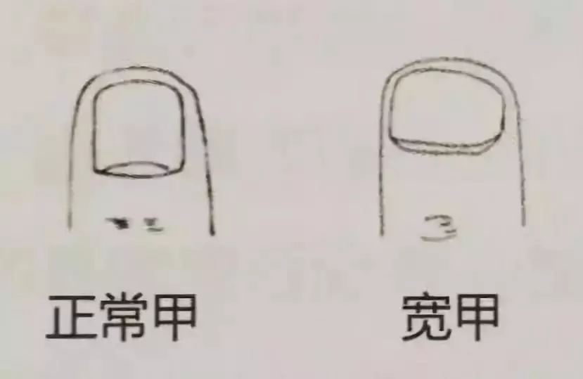 科普指甲怎么来的,关于指甲的科普视频