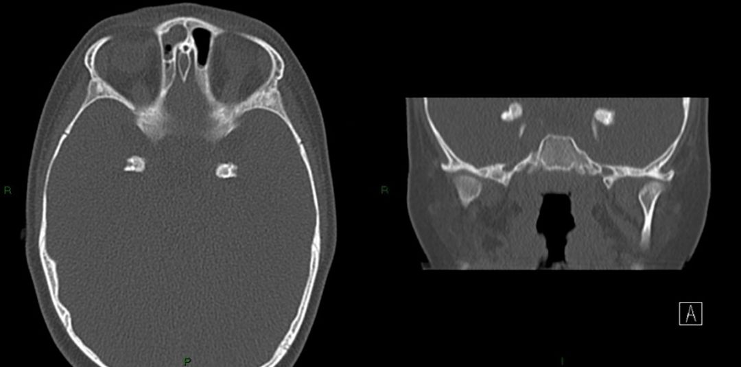 神经影像,神经影像解剖图