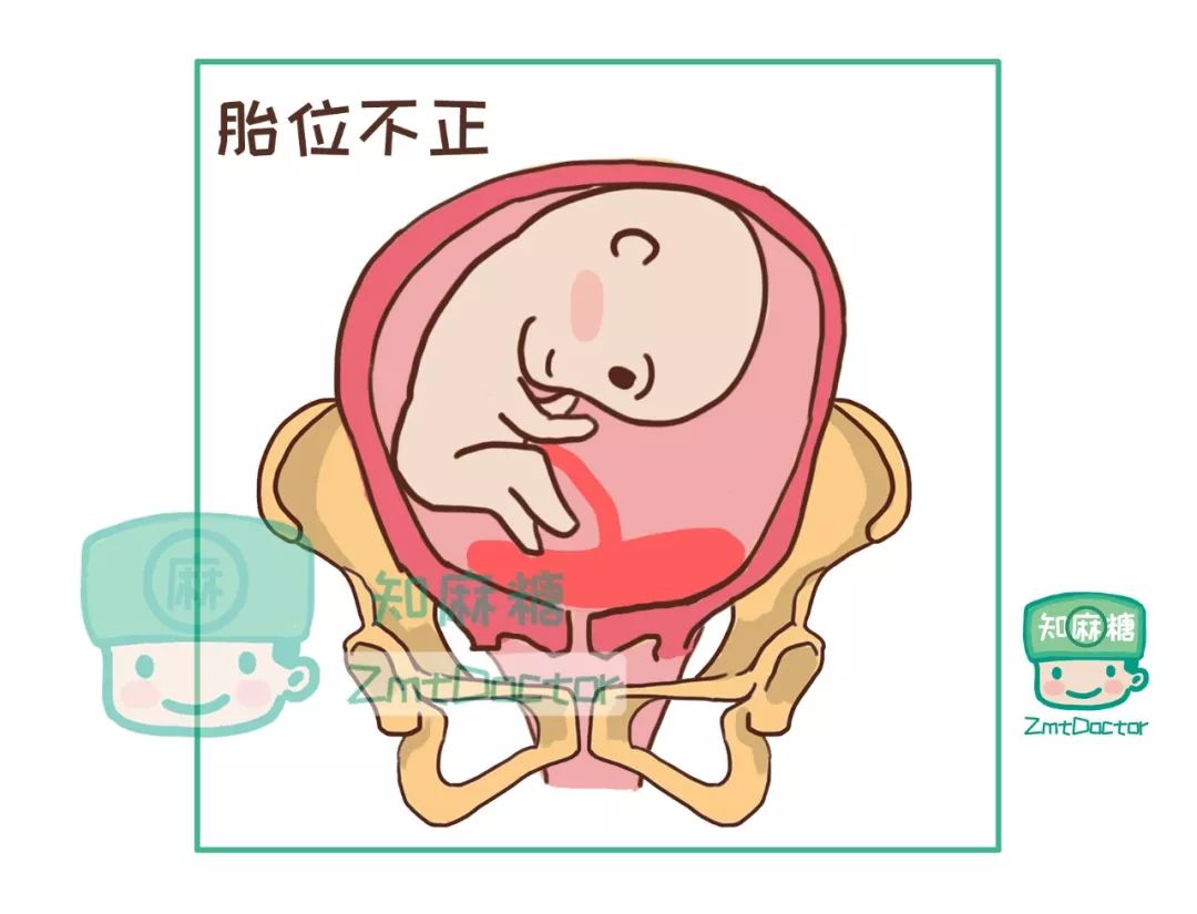 给妈妈健康最好的礼物,适合孕妈妈的轻奢礼物