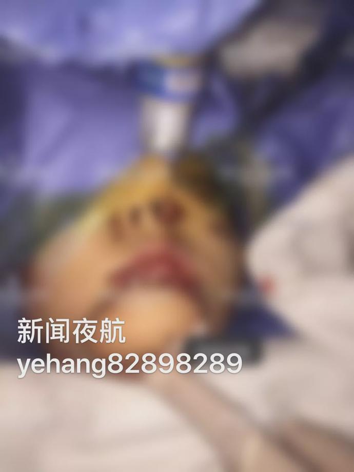 男孩模仿吃鸡死亡,男童模仿吃鸡游戏差点毁容