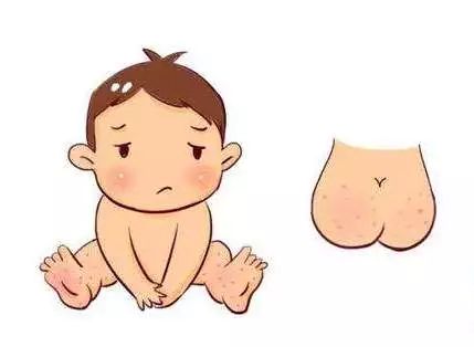 紫癜有发烧的症状怎么办,紫癜患者发烧后有什么后果