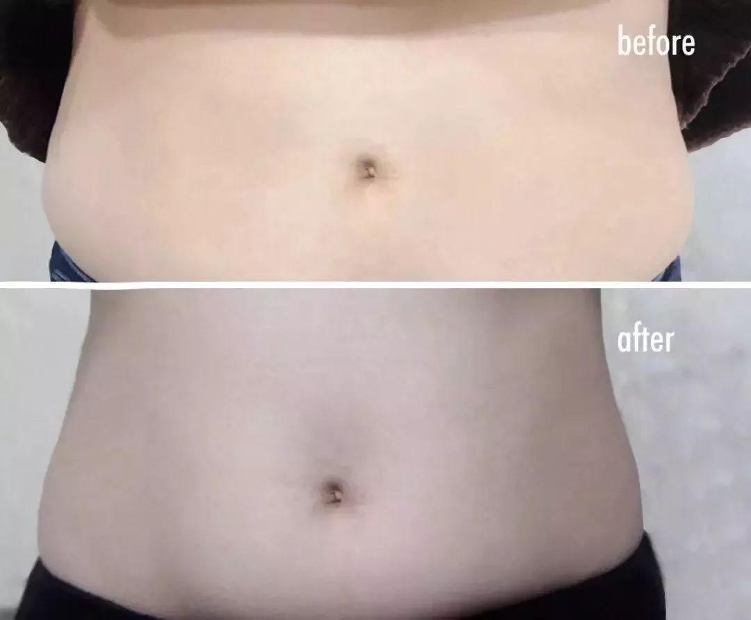 给肠道洗个澡，便秘、口臭、大肚腩都没了