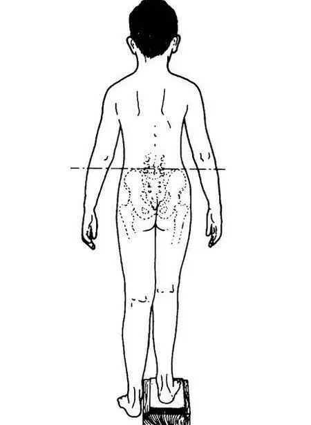 三招矫正长短腿,长短腿懒人矫正法