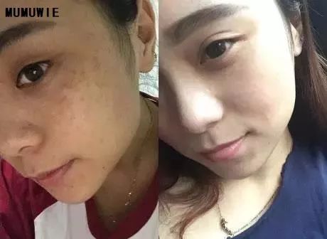 一招改善肩部疼痛,4个方法缓解肩周疼痛