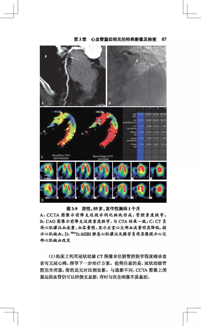 阜外医院心血管专家讲心血管视频,阜外心血管最新治疗手段