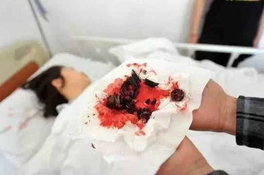 这种椅子会“吃”人！有人被炸飞，赶紧自查