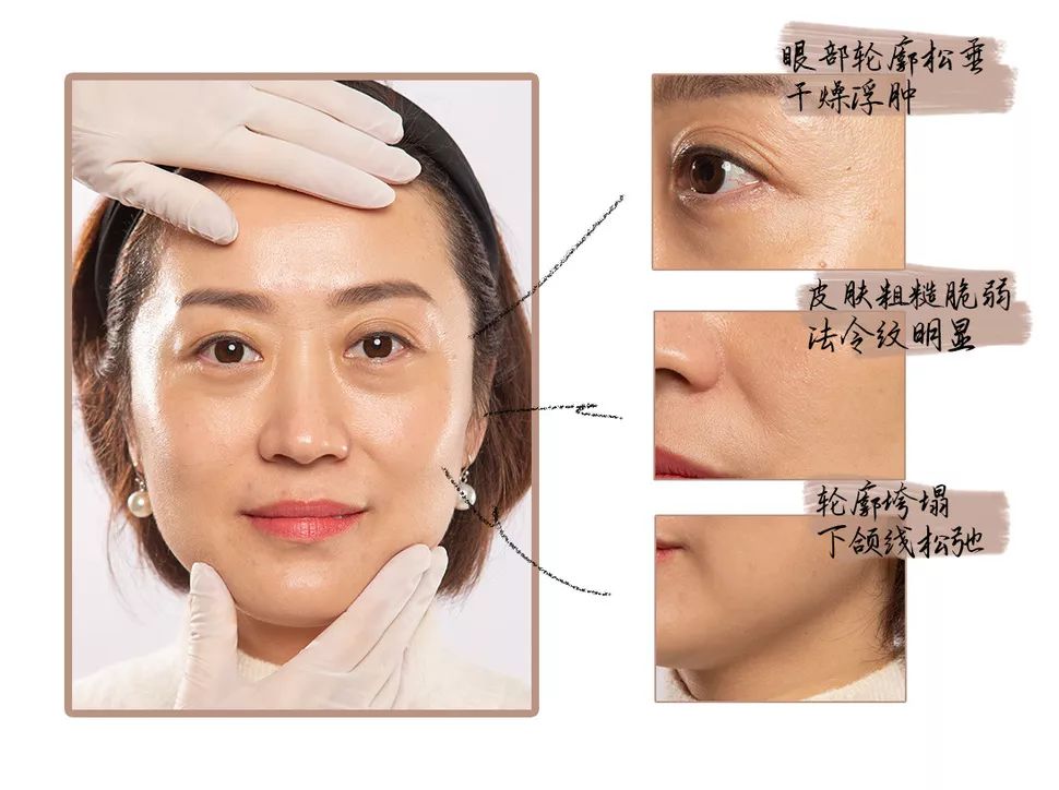 抗老三部曲紧致少女肌,抗老做好这五步hold住童颜少女肌