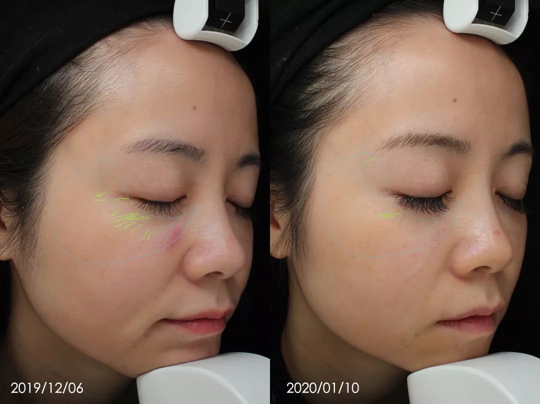 地表最强修复肌肤屏障,地表最强肌诊室