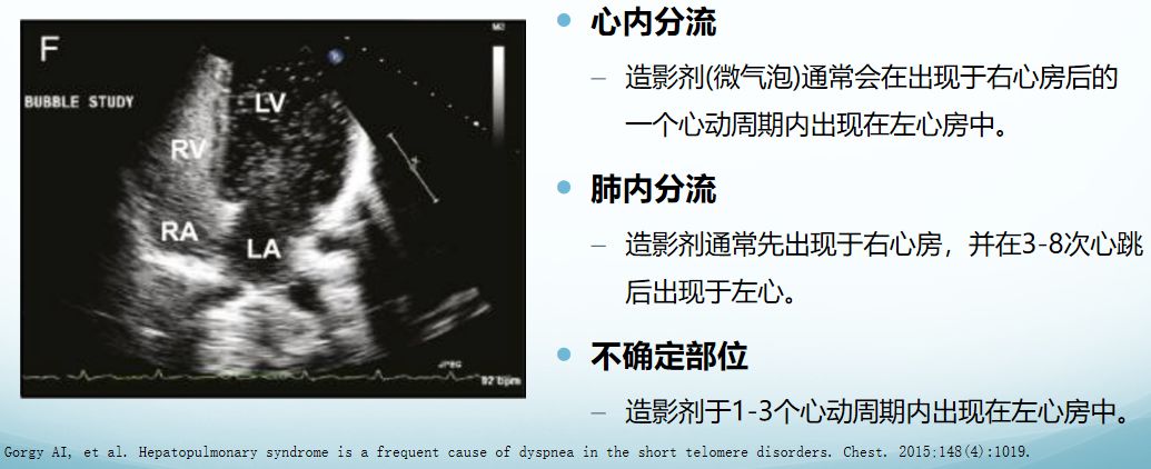 肝硬化肝肺综合征一般活多久,肝性脑病是肝硬化最严重的并发症