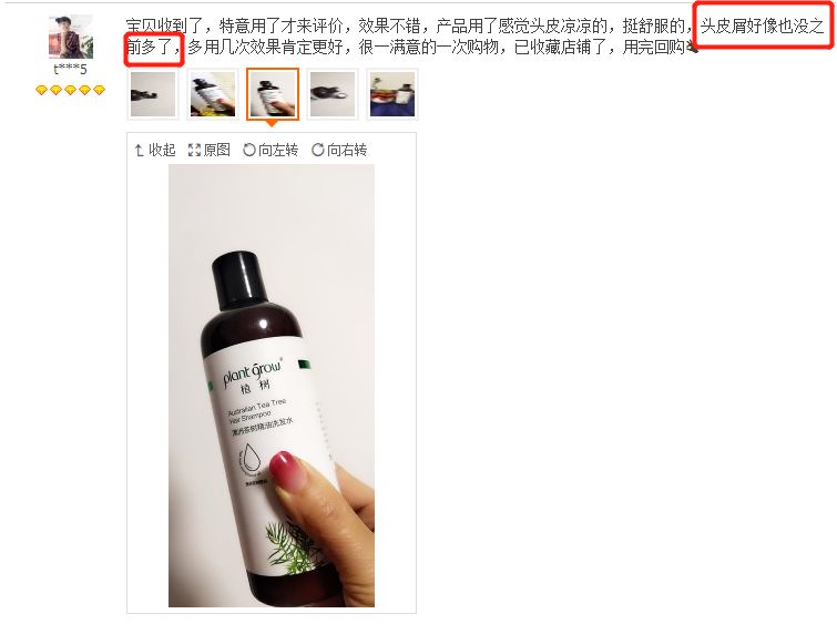 头上又油又有头皮屑又痒怎么办,头上又痒又油有头屑