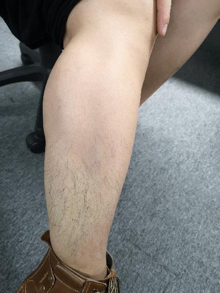 有没有一款真正永久脱毛的脱毛膏,你还在用剃须刀刮胡子吗