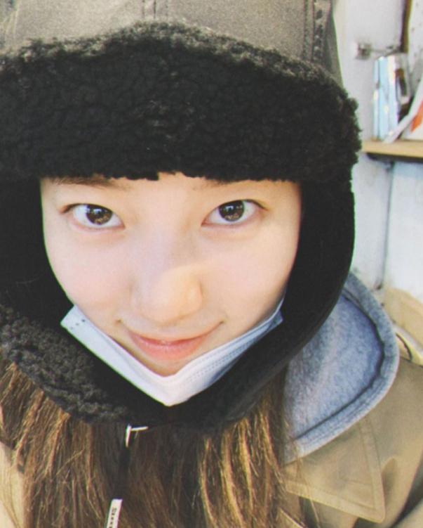 戴口罩皮肤病怎么预防,戴口罩皮肤起痘怎么办