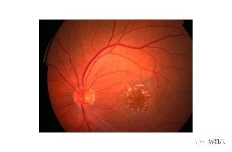 复习这些名解时总觉得怪饿的|协和八·脑洞大开