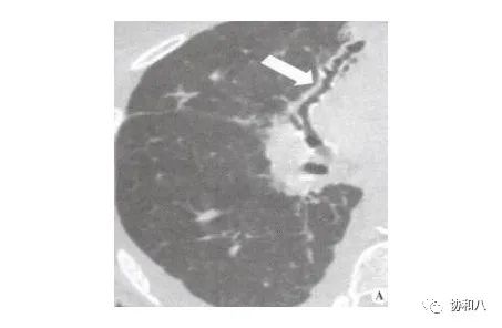 复习这些名解时总觉得怪饿的|协和八·脑洞大开