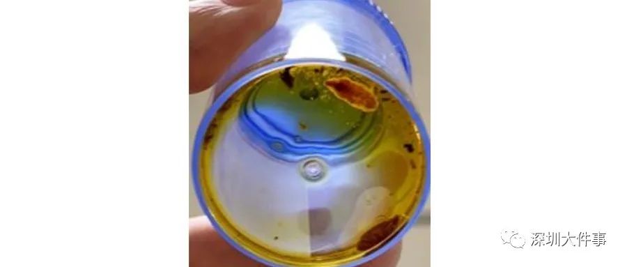 女子体内活虫蠕动只因爱吃这道菜,女子体内取出活虫只因吃过这道菜