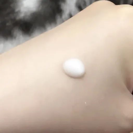 十大皮肤问题,所有皮肤问题都能解决