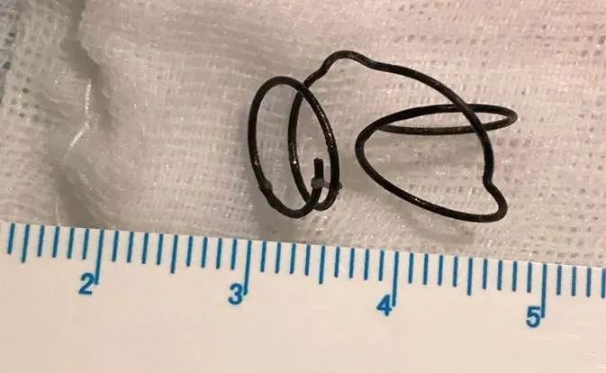 孩子反复呕吐喝水都吐咳嗽,引起一岁宝宝干呕的原因