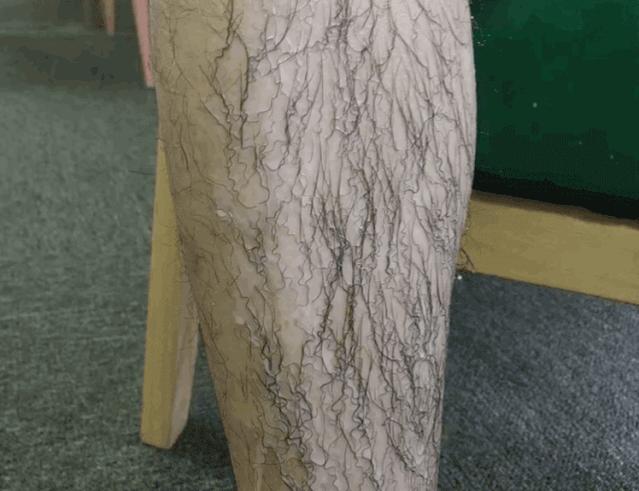 光滑无暇|黑丑的“毛裤腿”，用它，10分钟“脱”得一干二净，肌肤光滑细腻