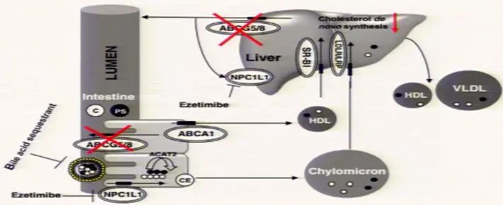 多发性黄色瘤,胆固醇高引起的黄色瘤是什么样的