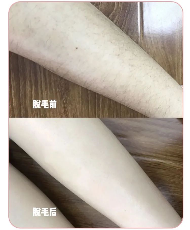 正品不刺激皮肤脱毛膏,猕猴桃脱毛膏哪种最好