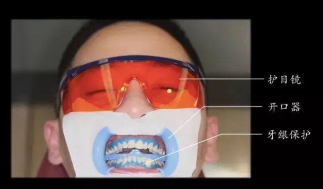 牙科医生教你牙齿美白,牙齿黄渍刷不干净老牙医教你一招