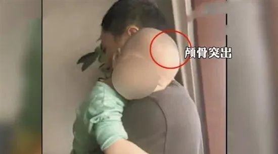 大头娃娃奶粉事件长沙,大头娃娃奶粉事件判刑