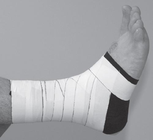 足球小将接连受伤，运动医学科专家敲黑板提醒