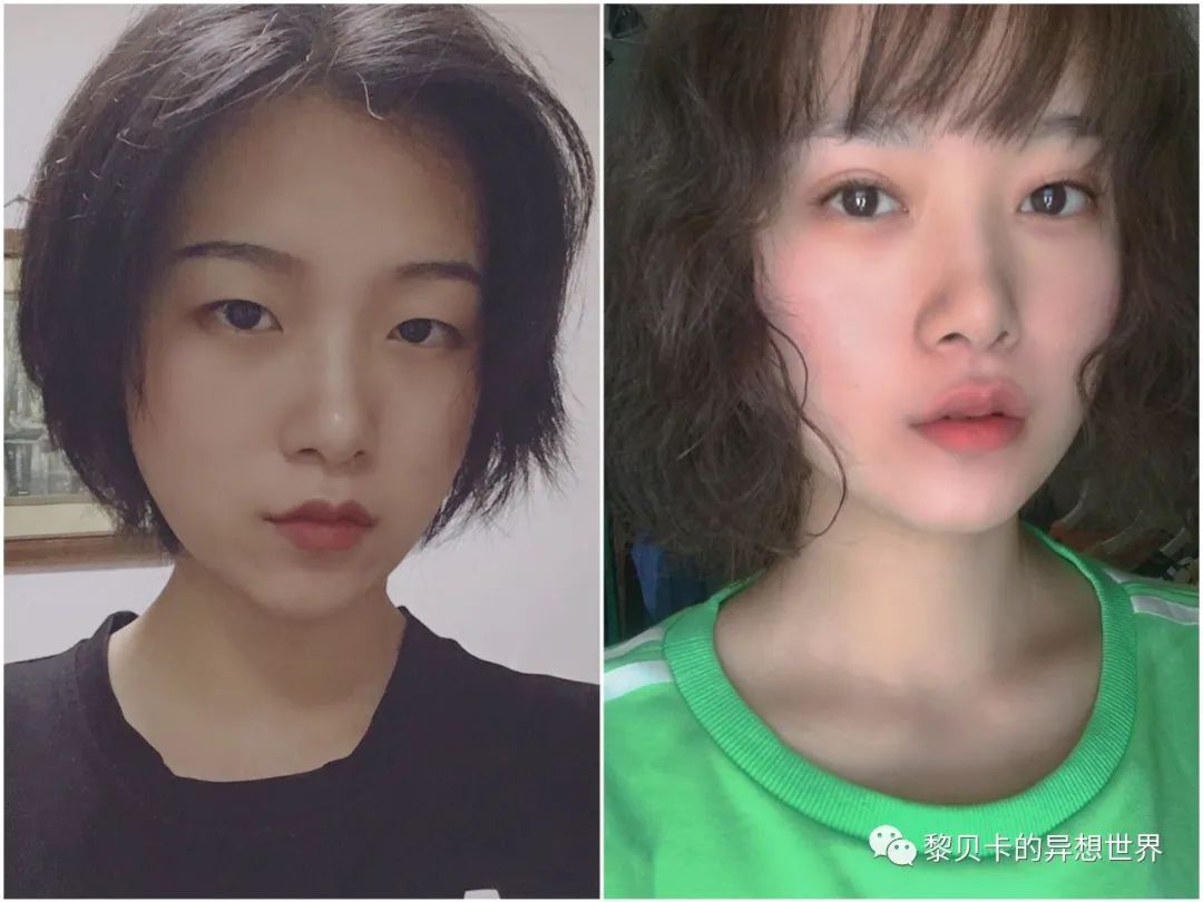 做完医美真的能换脸吗,做完医美需要注意什么