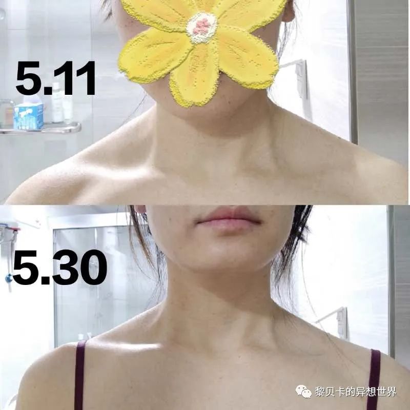 做完医美用可复美吗,你知道做完医美有多可怕