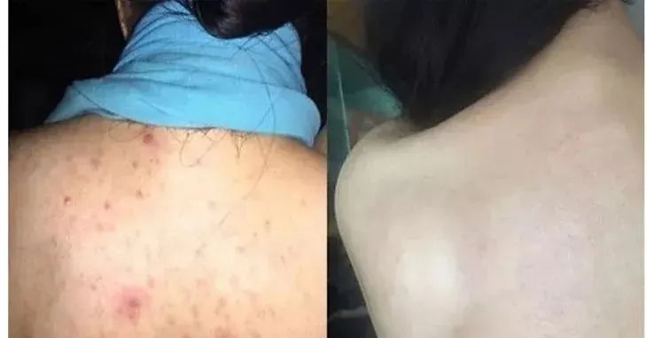 团|墙上插上它，24小时物理除螨，让千万螨虫集体自杀，比太阳暴晒强10000倍