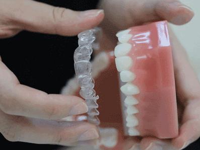 好羡慕别人有一口好牙齿,早日拥有一口整齐更漂亮的牙齿