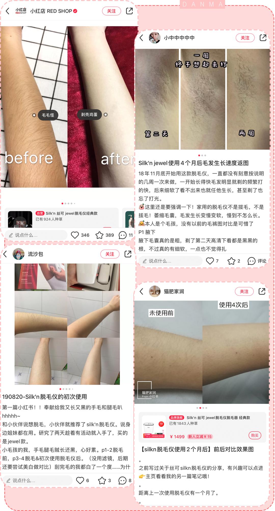 超良心真人测评！花了28天，告诉你脱毛仪到底值不值得买|辣妈研究所065