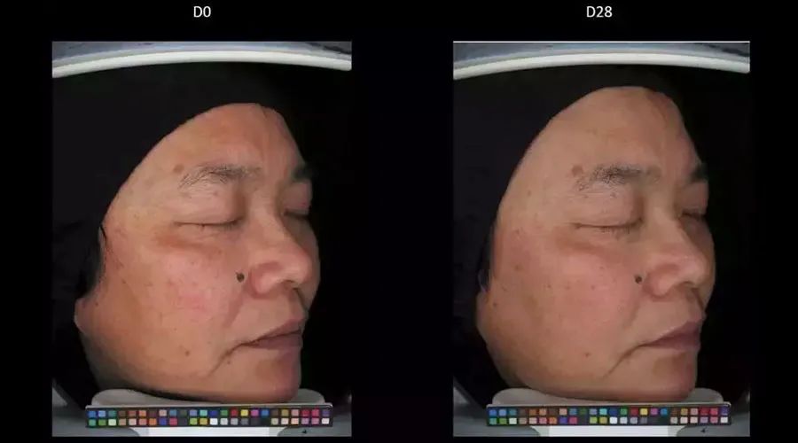 女生变白的正确方式,女生想要变白到底有多简单