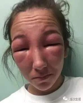 全球最毒的十大毒动物,加拿大最可怕的蛇