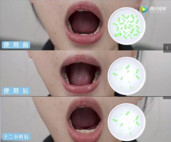 口臭的解决方法胃不好,口臭可能是你的胃出了问题