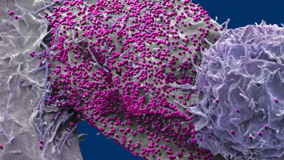 艾滋病66天阴性可以排除吗,艾滋病感染者开始抗hiv治疗的时机