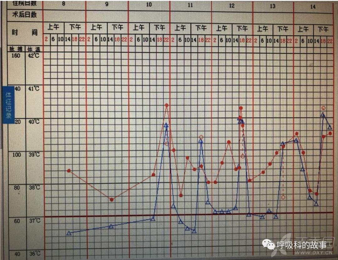 五花八门的发热之一—药物热（1）