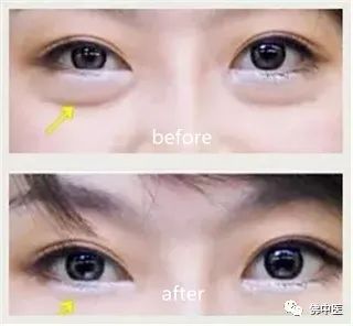 爱美小窍门有哪些,爱美小技巧女生